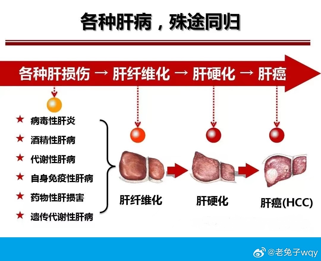 肝病最新疗法